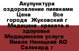 Акупунктура, оздоровление пиявками › Цена ­ 3 000 - Все города, Жуковский г. Медицина, красота и здоровье » Медицинские услуги   . Ямало-Ненецкий АО,Салехард г.